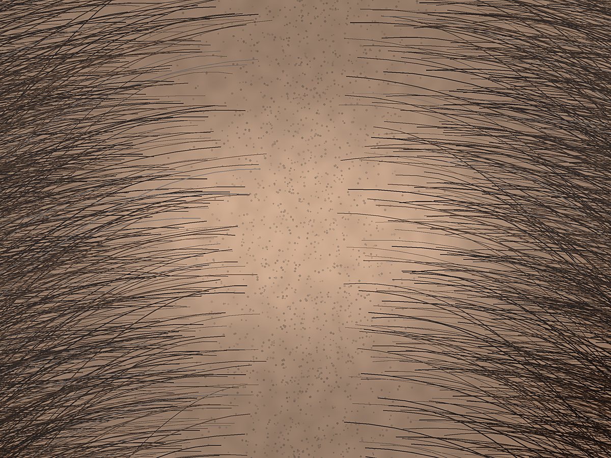 A scalp at the part line in week zero, with a wide band of visible skin between sparse strands.